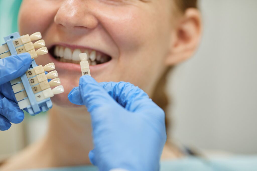מחיר השתלות שיניים