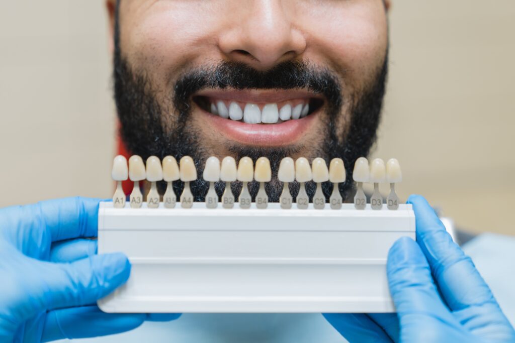 ציפויי שיניים זירקוניה לעומת חרסינה