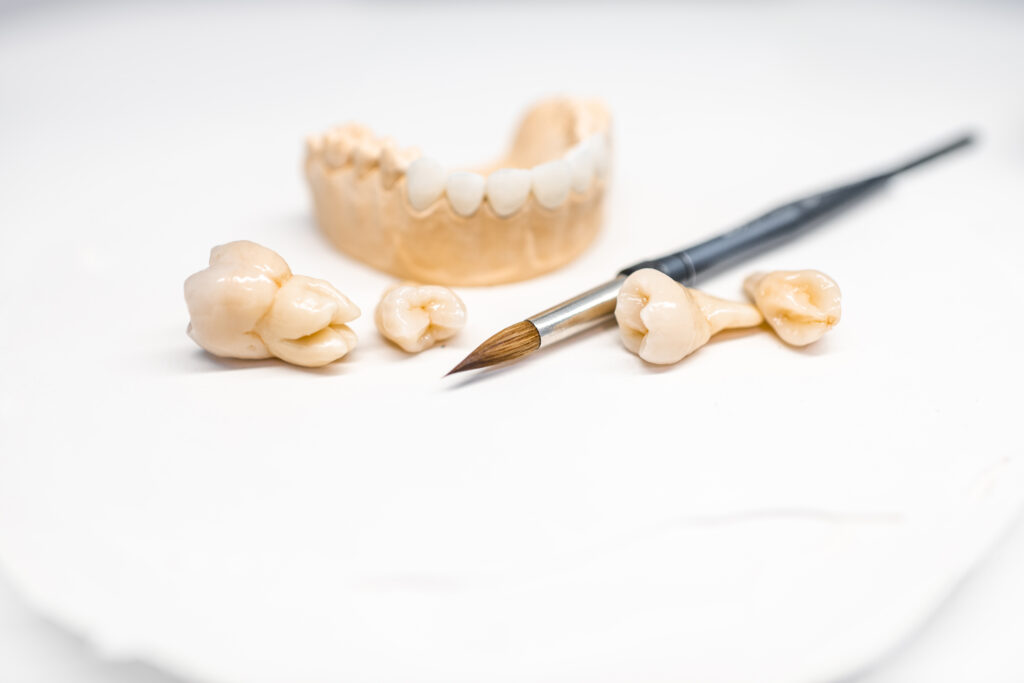 היתרונות של בחירת כתר זירקוניה לשיקום השיניים