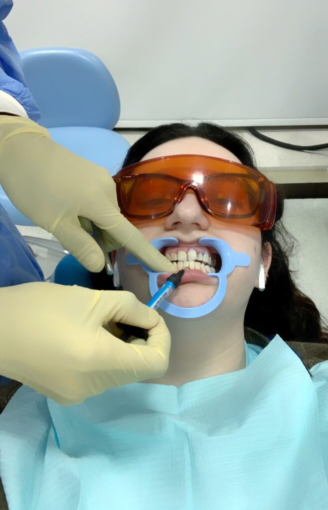 איזה ערך הלבנת שיניים מקצועית תביא לחייכם?