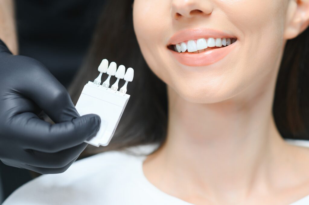 התאמת ערכה להלבנת שיניים ביתית למטופלת
