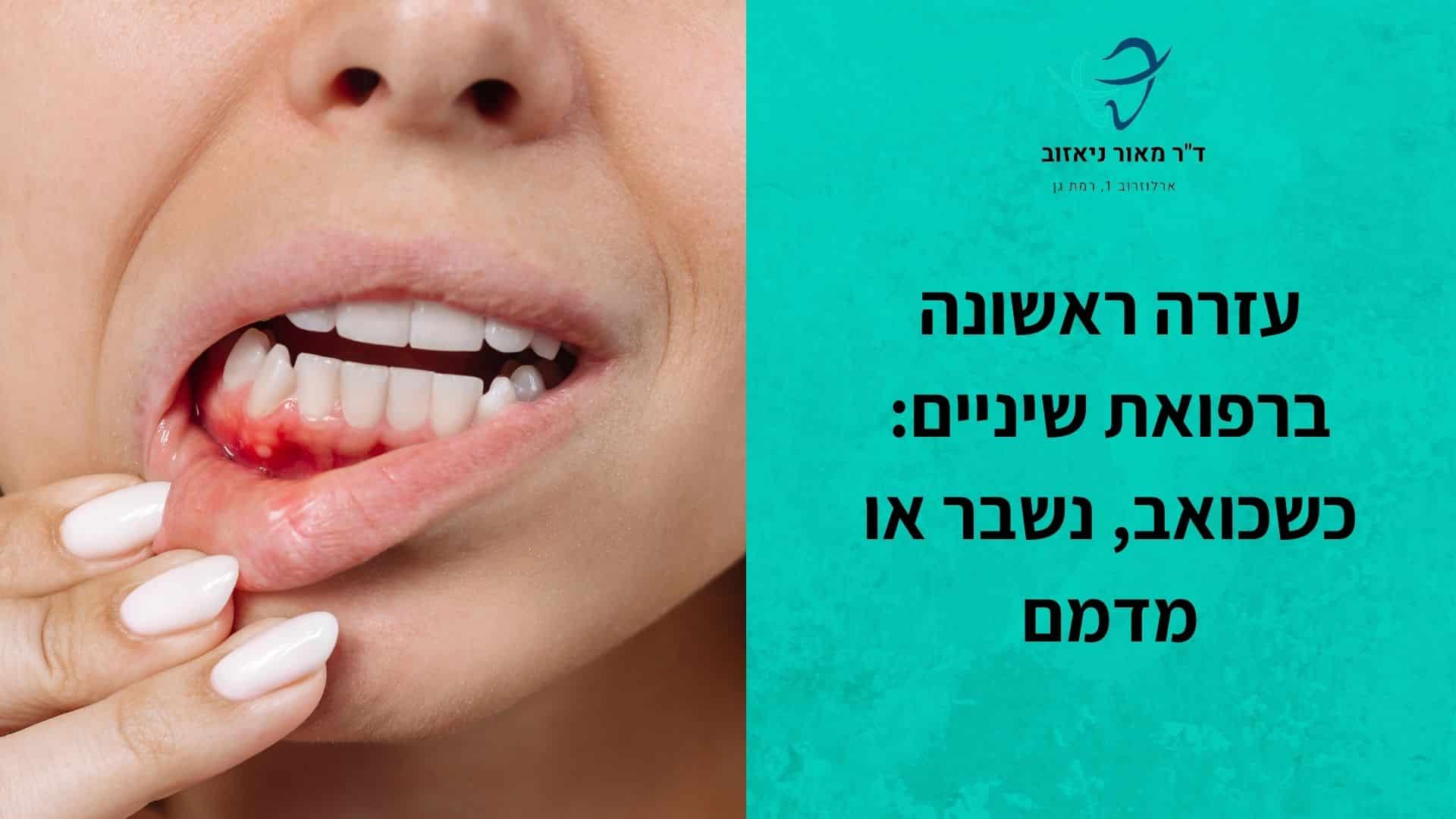 עזרה ראשונה ברפואת שיניים